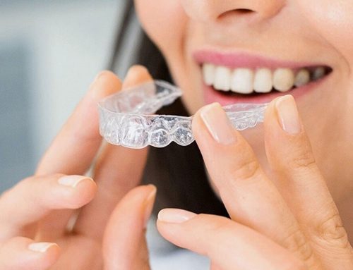 Orthodontics in Miami Lakes & Pembroke Pines