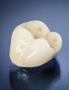 Porcelain crowns