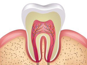 Root Canal Miami